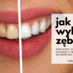 jak wybielić zęby cena nakładki lampa